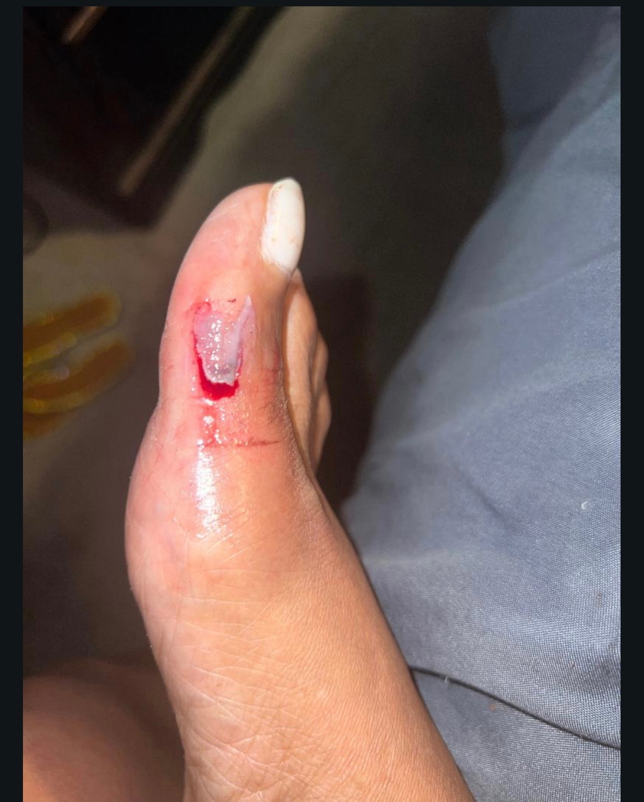 Before photo shared by Keena F