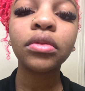 Before photo shared by Rodnae A